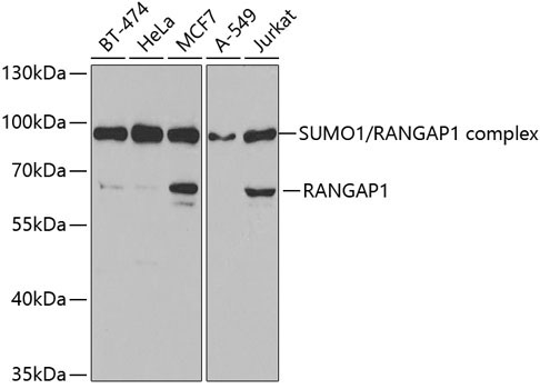 RanGAP1 Rabbit Polyclonal Antibody