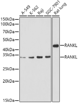 RANKL Rabbit Polyclonal Antibody