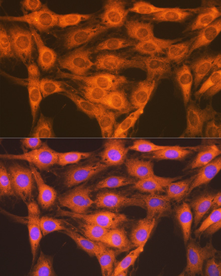 RAP1A + RAP1B Rabbit Monoclonal Antibody - Image 2