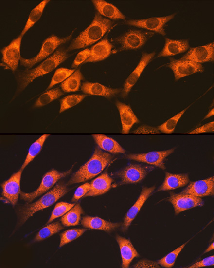 RAP1A + RAP1B Rabbit Monoclonal Antibody - Image 3