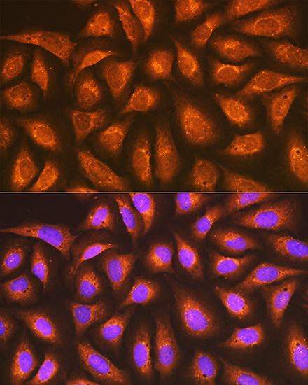 RAP1A + RAP1B Rabbit Monoclonal Antibody - Image 4
