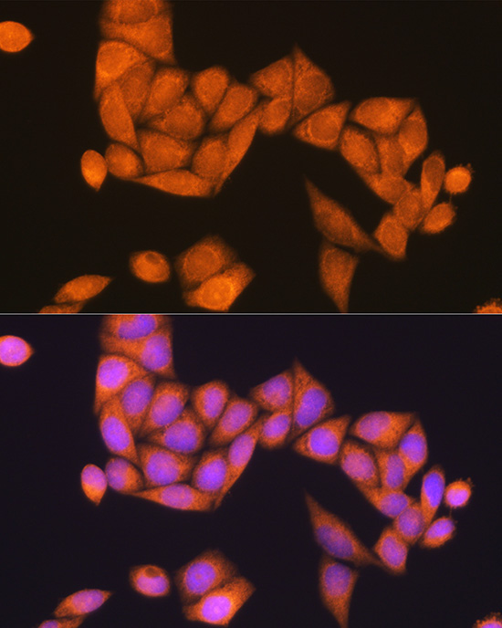 Rap1B Rabbit Polyclonal Antibody - Image 2