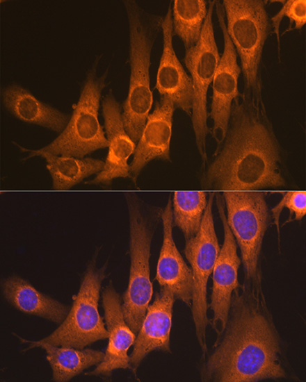 Rap1GAP Rabbit Monoclonal Antibody - Image 2