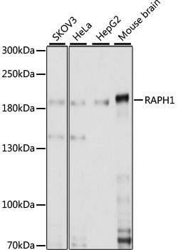 RAPH1 Rabbit Polyclonal Antibody