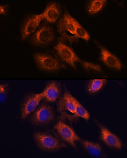 RAPH1 Rabbit Polyclonal Antibody - Image 2