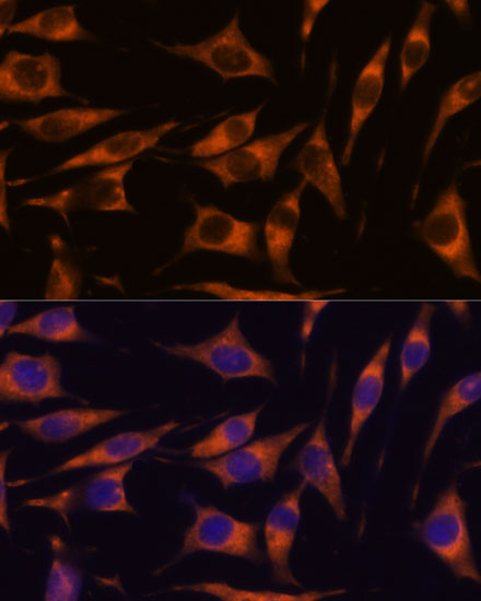 RAPH1 Rabbit Polyclonal Antibody - Image 3