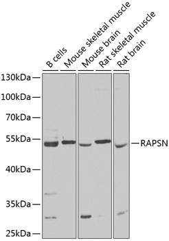 RAPSN Rabbit Polyclonal Antibody