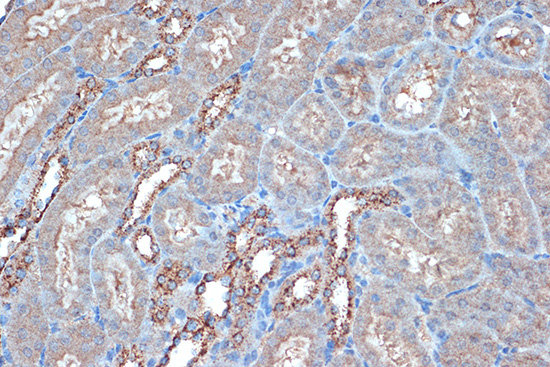 Raptor Rabbit Monoclonal Antibody - Image 2