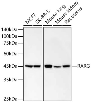 RARG Rabbit Monoclonal Antibody