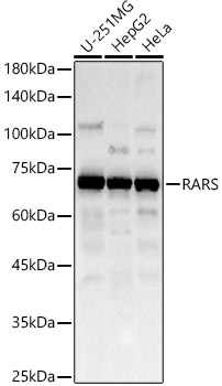 RARS Rabbit Polyclonal Antibody