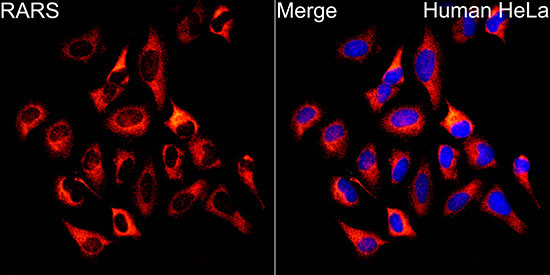 RARS Rabbit Polyclonal Antibody - Image 2