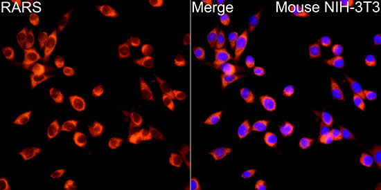 RARS Rabbit Polyclonal Antibody - Image 3