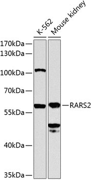 RARS2 Rabbit Polyclonal Antibody