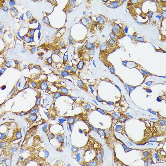 RARAlpha Rabbit Monoclonal Antibody - Image 2