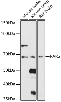 RARAlpha Rabbit Polyclonal Antibody - Image 2