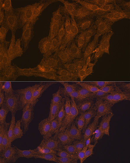 RARAlpha Rabbit Polyclonal Antibody - Image 3