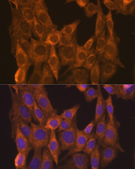 RARAlpha Rabbit Polyclonal Antibody - Image 4