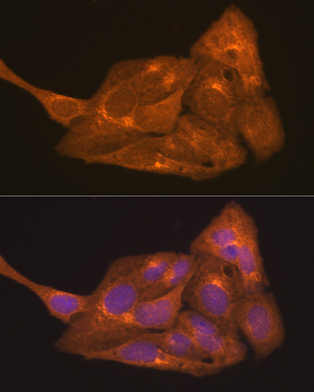 RARAlpha Rabbit Polyclonal Antibody - Image 5