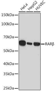 RARBeta Rabbit Monoclonal Antibody