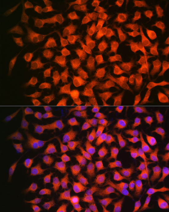 RARBeta Rabbit Monoclonal Antibody - Image 2