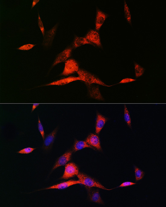 RARBeta Rabbit Monoclonal Antibody - Image 3