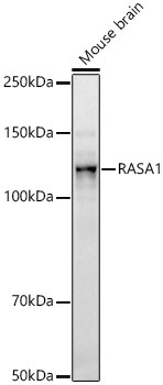 RASA1 Rabbit Monoclonal Antibody - Image 2