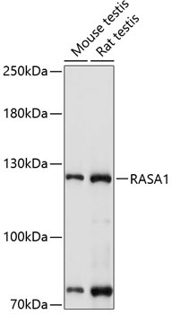 RASA1 Rabbit Polyclonal Antibody