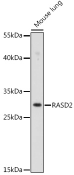 RASD2 Rabbit Polyclonal Antibody