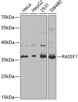 RASSF1 Rabbit Polyclonal Antibody