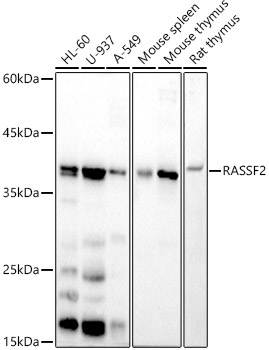 RASSF2 Rabbit Monoclonal Antibody