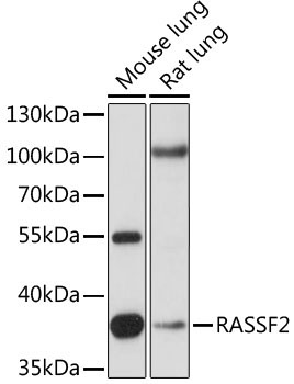 RASSF2 Rabbit Polyclonal Antibody