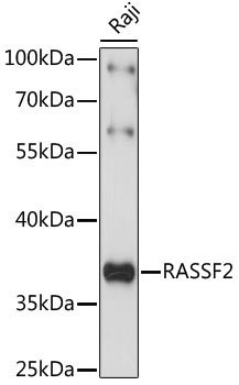 RASSF2 Rabbit Polyclonal Antibody
