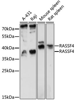 RASSF4 Rabbit Polyclonal Antibody
