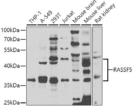 RASSF5 Rabbit Polyclonal Antibody