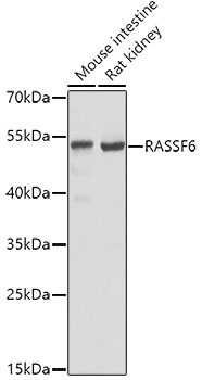 RASSF6 Rabbit Polyclonal Antibody