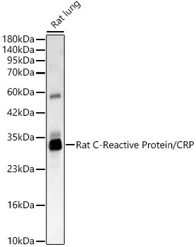 Rat C-Reactive Protein/CRP Rabbit Polyclonal Antibody
