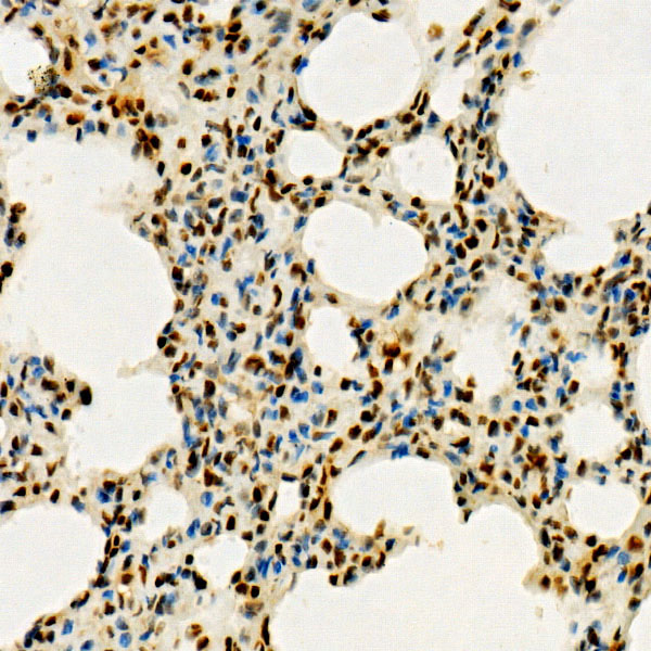 RB Rabbit Monoclonal Antibody - Image 2