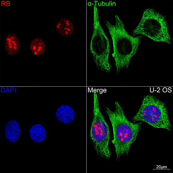 RB Rabbit Monoclonal Antibody