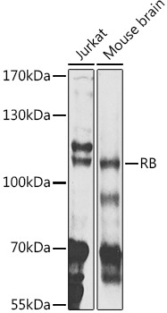 RB Rabbit Polyclonal Antibody
