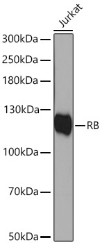 RB Rabbit Polyclonal Antibody