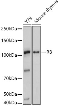 RB Rabbit Polyclonal Antibody