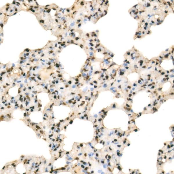 RbAp46/RBBP7 Rabbit Polyclonal Antibody - Image 3