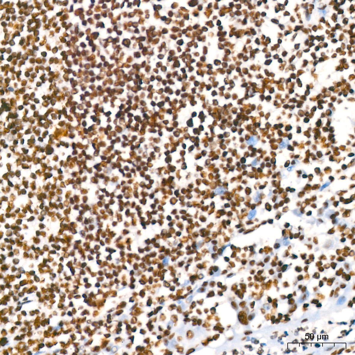 RBBP4 Rabbit Monoclonal Antibody - Image 3