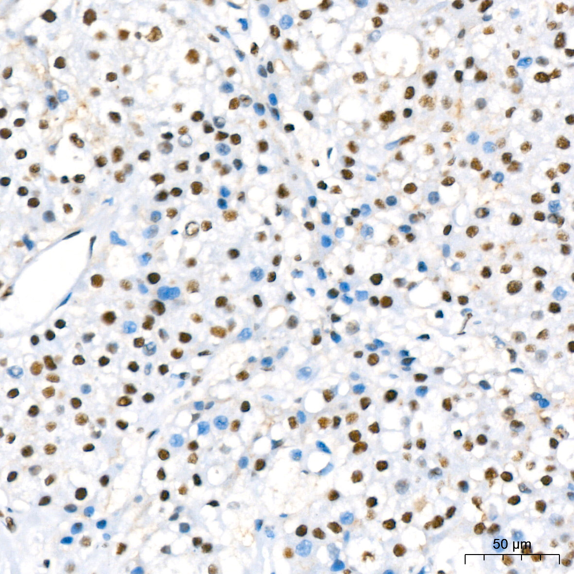 RBBP4 Rabbit Monoclonal Antibody - Image 6