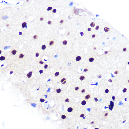 RBBP4 Rabbit Monoclonal Antibody - Image 10