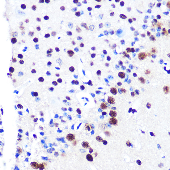 RBBP4 Rabbit Monoclonal Antibody - Image 12