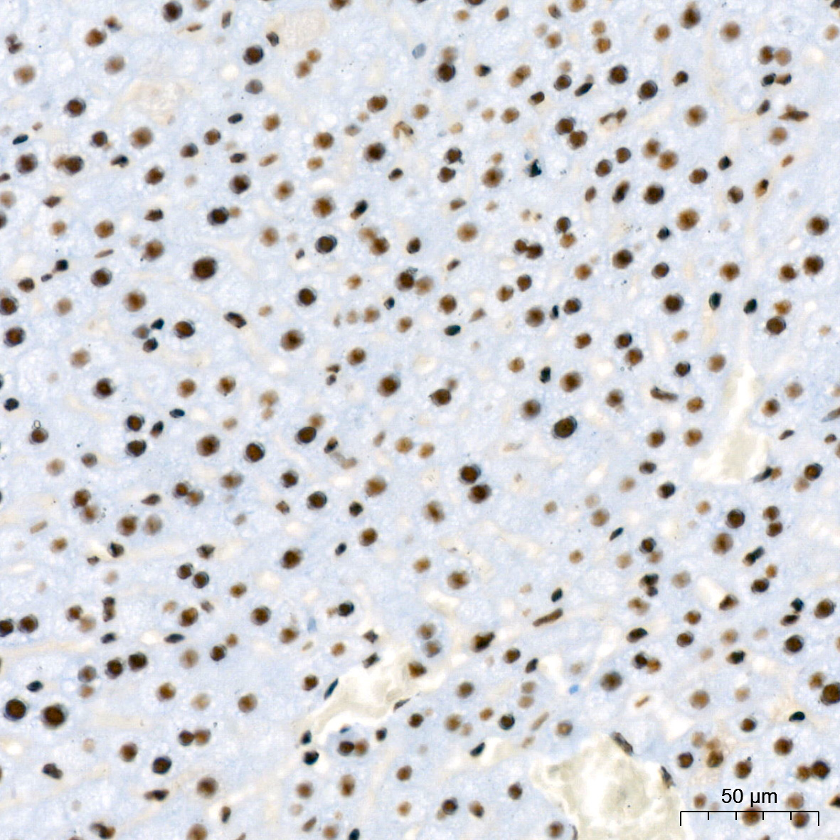 RBBP4 Rabbit Monoclonal Antibody - Image 15