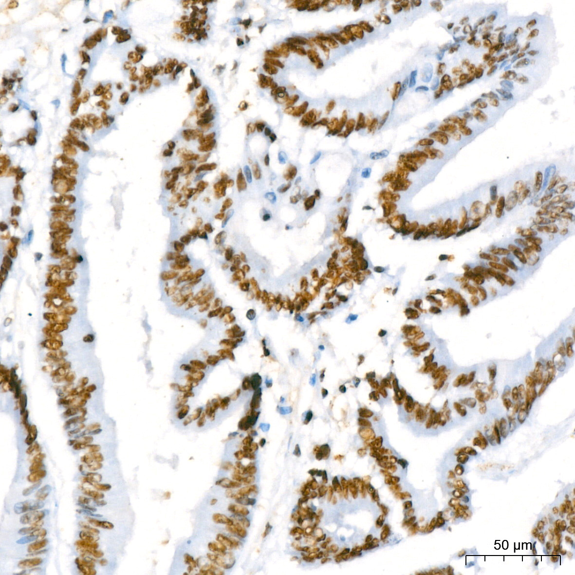 RBBP4 Rabbit Monoclonal Antibody - Image 16
