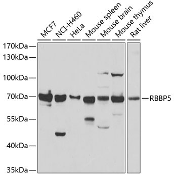 RBBP5 Rabbit Polyclonal Antibody