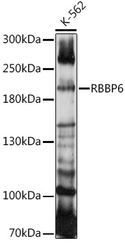 RBBP6 Rabbit Polyclonal Antibody